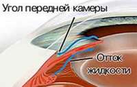 Глаукома