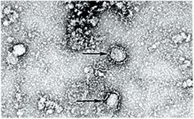 virus